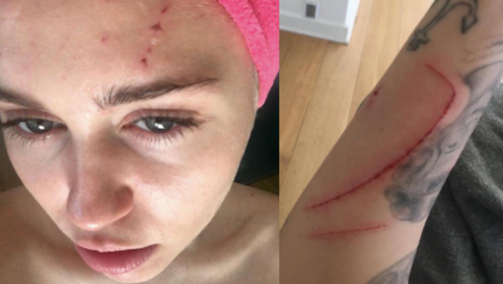 Miley Cyrus dotkliwie podrapana przez kota [ZDJĘCIA]