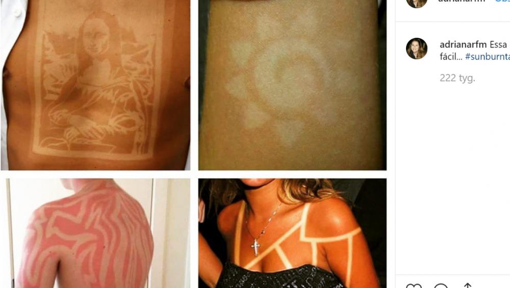 Tatuaże wypalane słońcem. Najlepsze i najgorsze przykłady tej mody