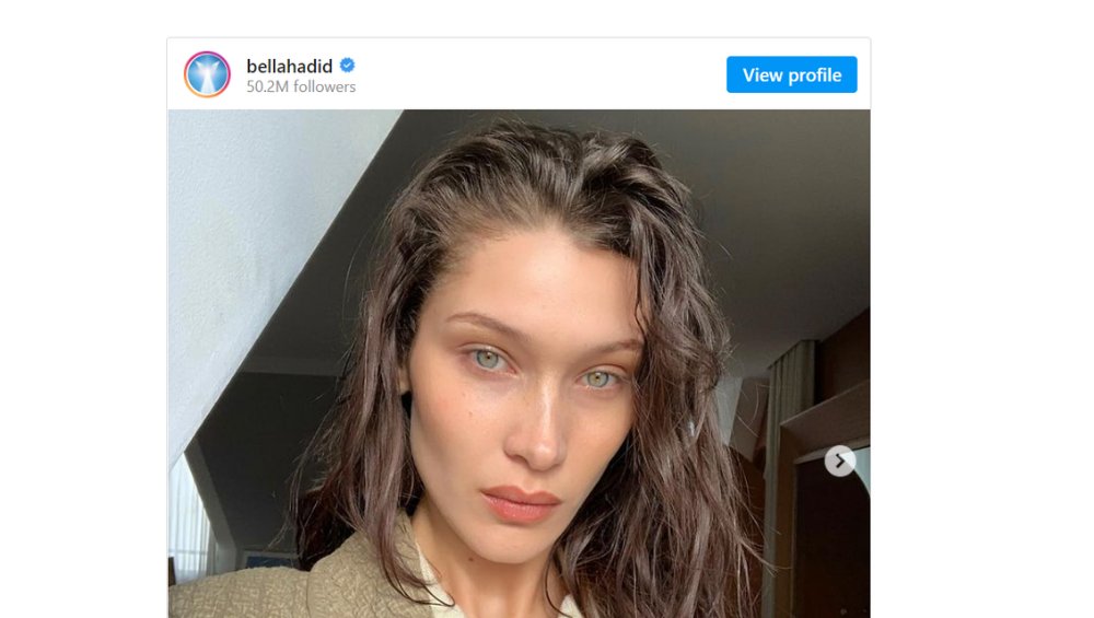 Bella Hadid miała operację nosa jako 14-latka. Czy żałuje? Bella Hadid miała operację nosa jako 14-latka. Czy żałuje?