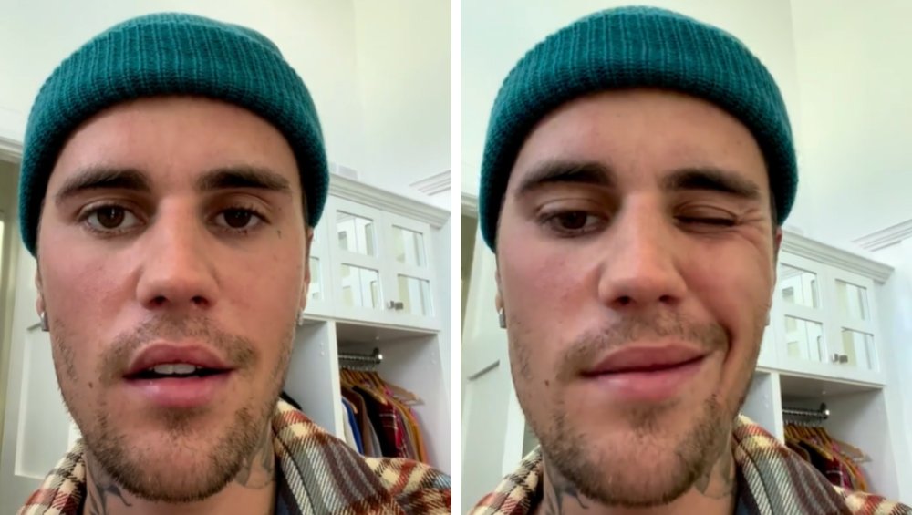 Justin Bieber ma paraliż twarzy. Pokazał wideo, prosi o modlitwę – jak zareagowała Hailey?