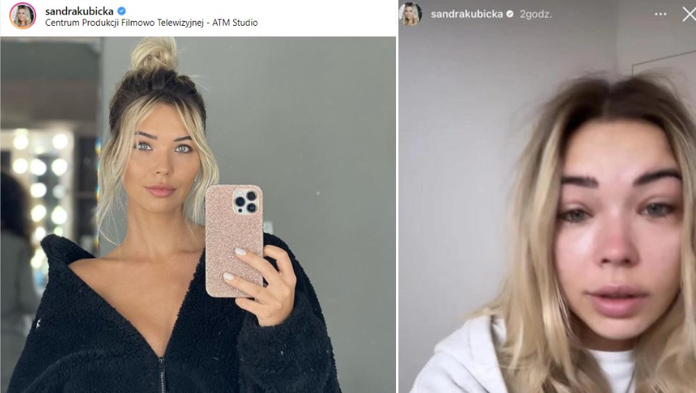 Sandra Kubicka trafiła do szpitala z ogromnym bólem. Zwróciła się do fanów Sandra Kubicka trafiła do szpitala z ogromnym bólem. Zwróciła się do fanów