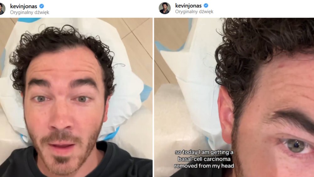 Kevin Jonas jest po operacji wycięcia nowotworu. Zaapelował do fanów Kevin Jonas jest po operacji wycięcia nowotworu. Zaapelował do fanów