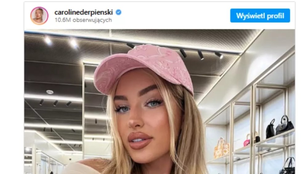 Caroline Derpienski przeszła prawdziwą metamorfozę. Wow!